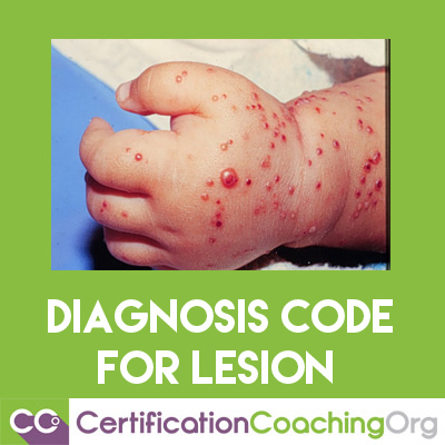 diagnosis code for lesion