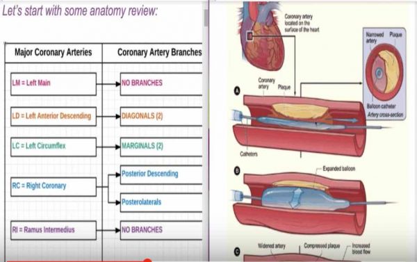 Percutaneous Coronary Intervention (PCI) CPT Coding - Angioplasty Coding