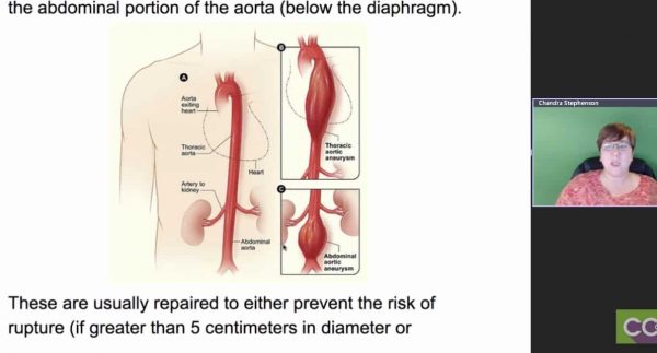 Abdominal Aortic Aneurysm Repair Coding | CPT Coding