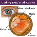 Coding Detached Retina — Video