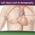 Coding Left Heart Cath and Aortography — VIDEO