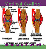 Medical Coding Rheumatoid Arthritis — Video