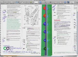 CPT Stents and Cardiac Cath Coding Tips