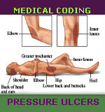 medical coding for pressure ulcers